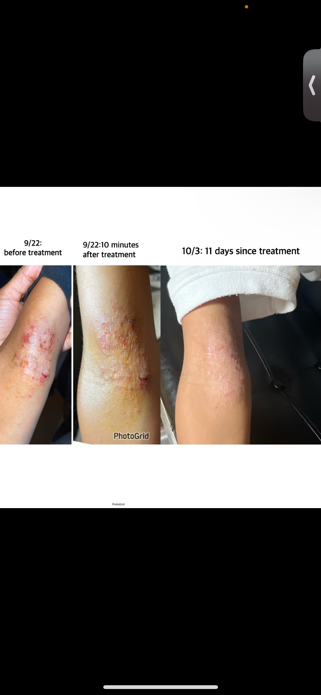 Antibacterial Oil